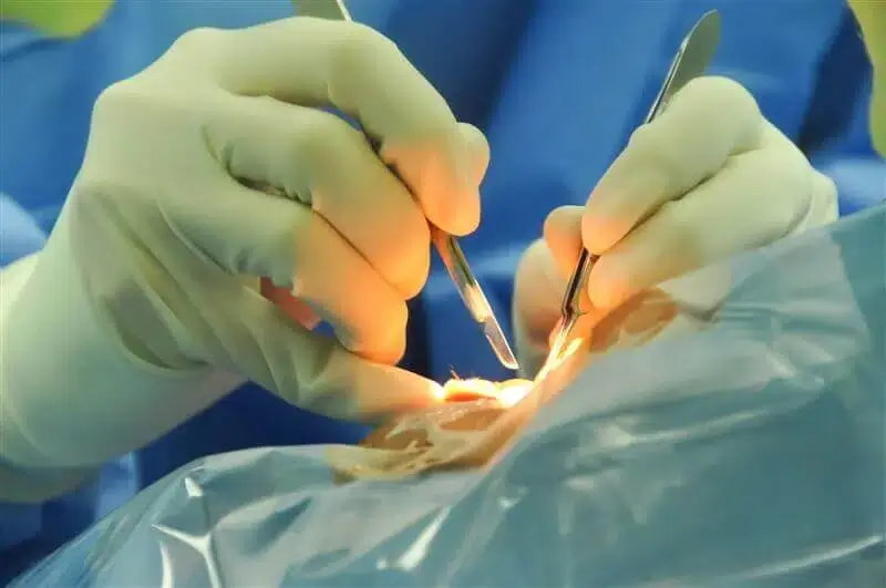 Menino de 13 anos faz cirurgia para aumentar tamanho do pénis