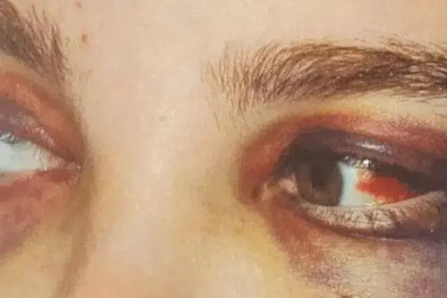 Casais acusados de torturar babá por mais de 16 horas