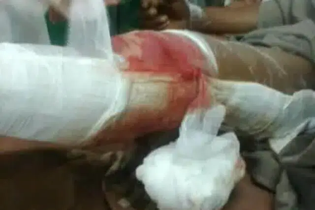 Assaltante alvejado pela polícia em Sofala