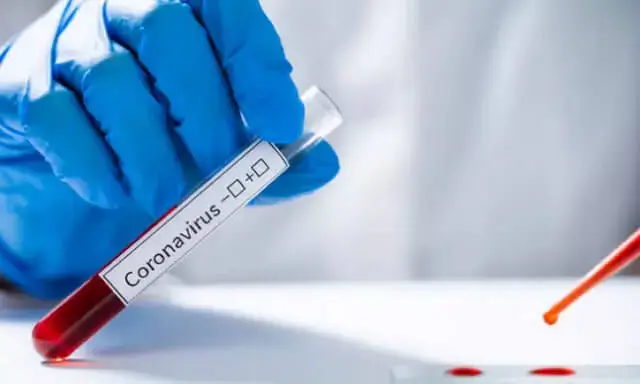 Moçambique e Angola apontados como exemplos no controlo da Covid-19