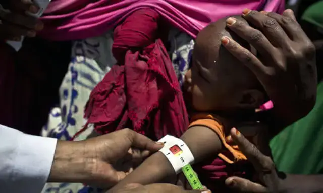 SADC 8,4 milhões de crianças poderão sofrer de desnutrição aguda este ano