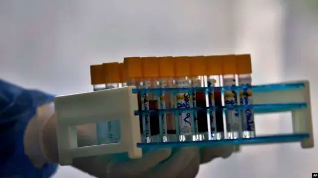 COVID-19 São Tomé e Príncipe massifica a testagem