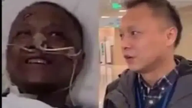 Médico chinês que mudou de cor devido à Covid-19 já recuperou tom de pele