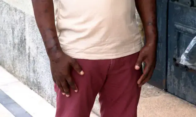 Mais de duas mil pessoas são diagnosticadas com lepra todos anos no país