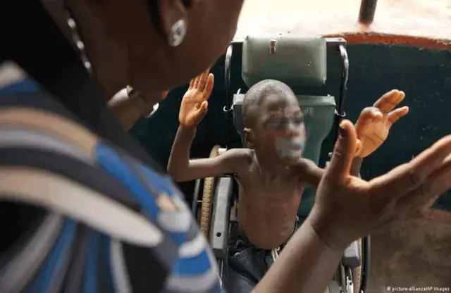 Faltam recursos no CREI de Anchilo para atender aos estudantes deficientes