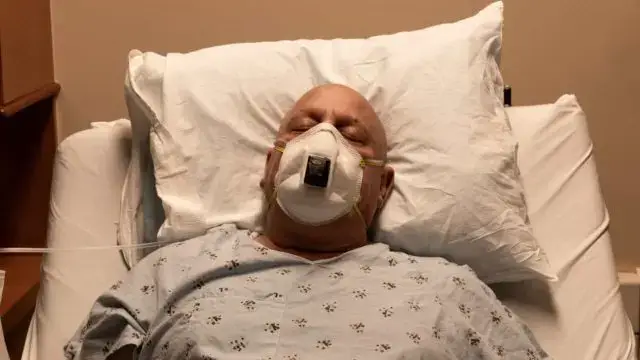 Homens carecas têm maior risco de sofrerem gravemente de Covid-19