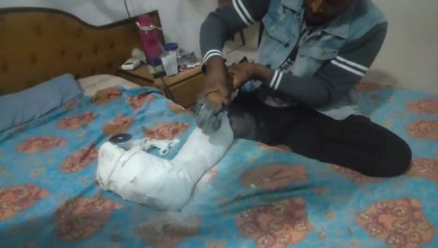 Paciente recorre a rebarbadeira para retirar gesso por falta de equipamento no hospital